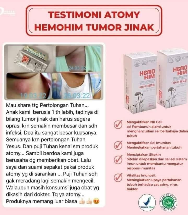 Testimoni HemoHiM tumor jinak