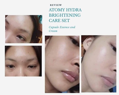 Testimoni Atomy Hydra Brightening