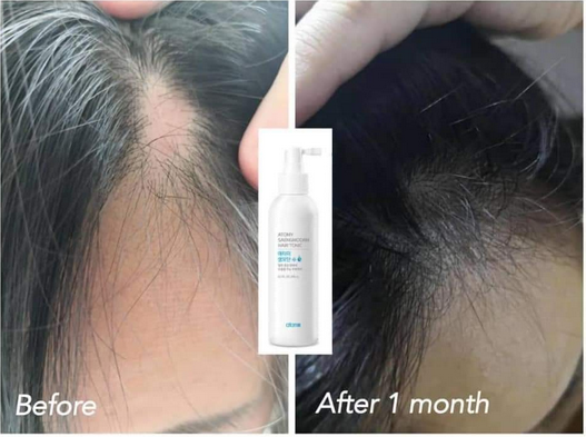 ATOMY HAIR TONIC Saengmodan 200 ml Original Korea